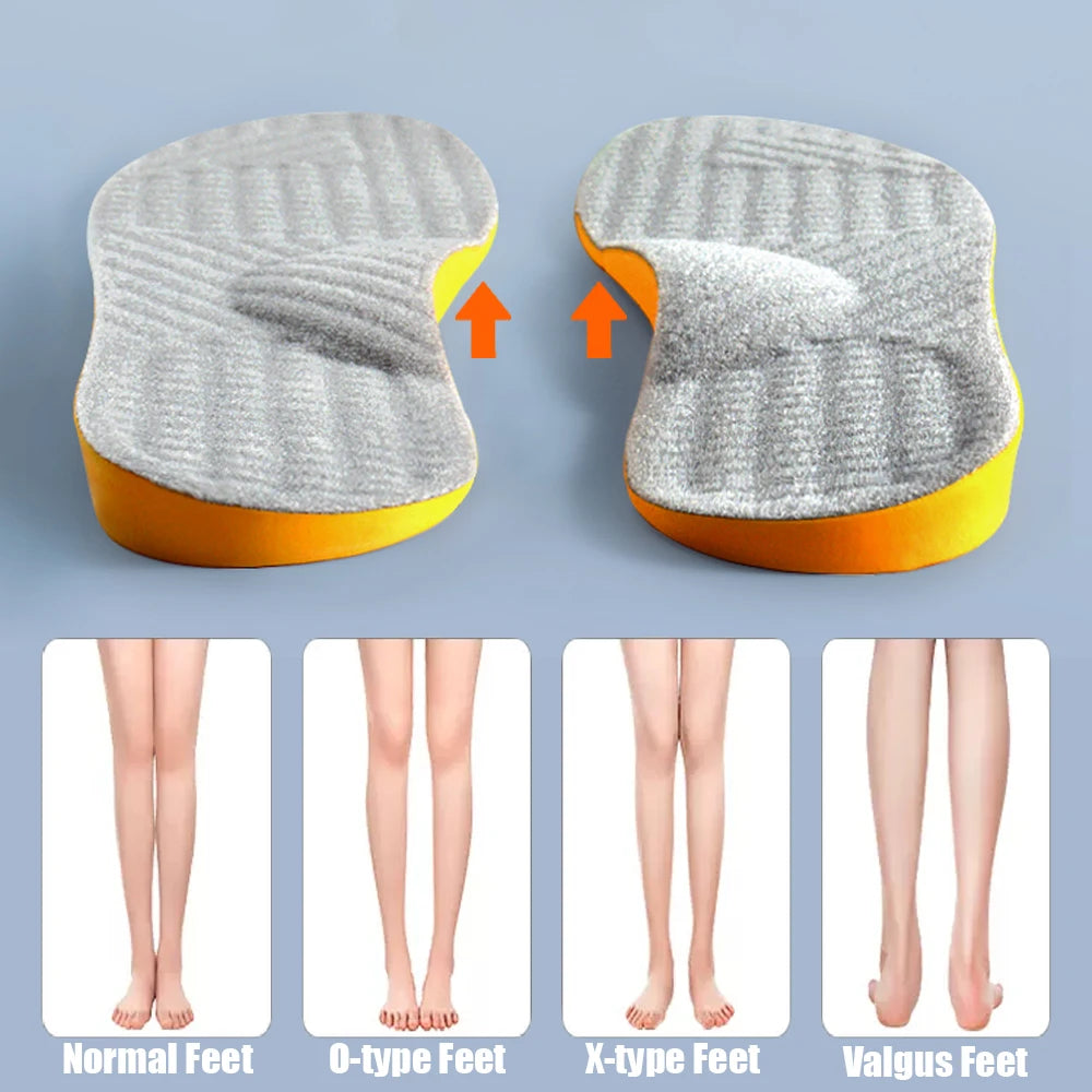 Arch Support Orthopedic Insoles (Flat Foot Correction, X/O Valgus) — Women/Men/Children