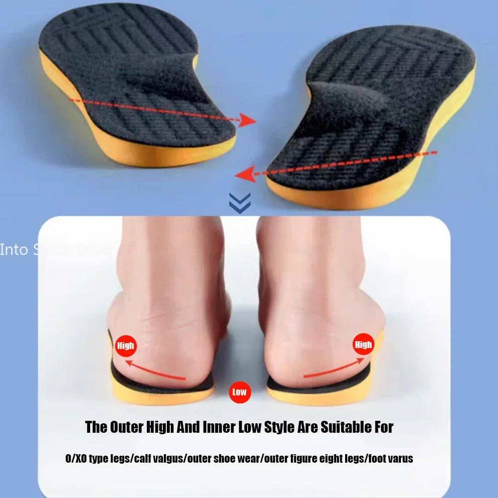 Arch Support Orthopedic Insoles (Flat Foot Correction, X/O Valgus) — Women/Men/Children
